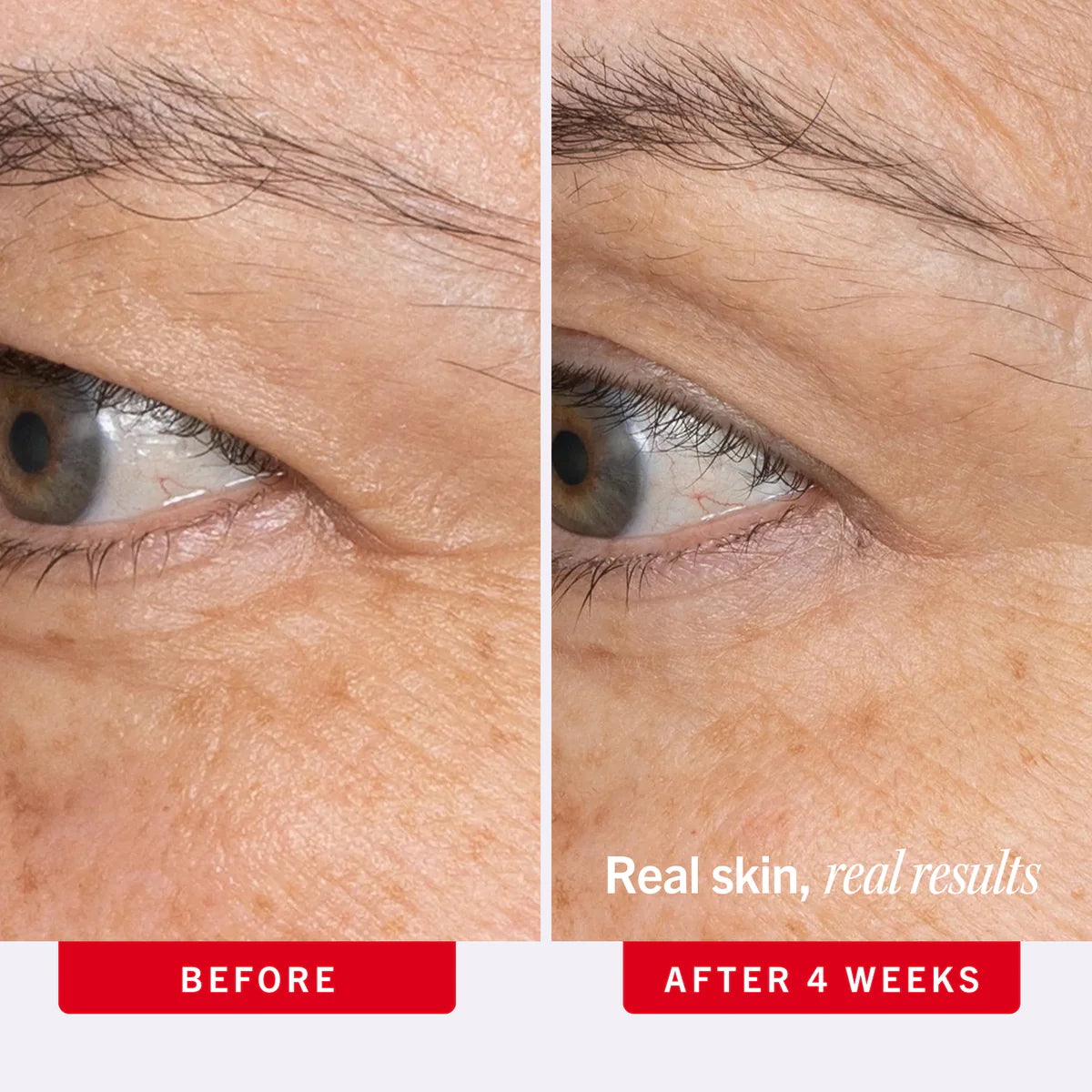 Crème contour des yeux au rétinol First Aid Beauty Ultra Repair (15 ml)